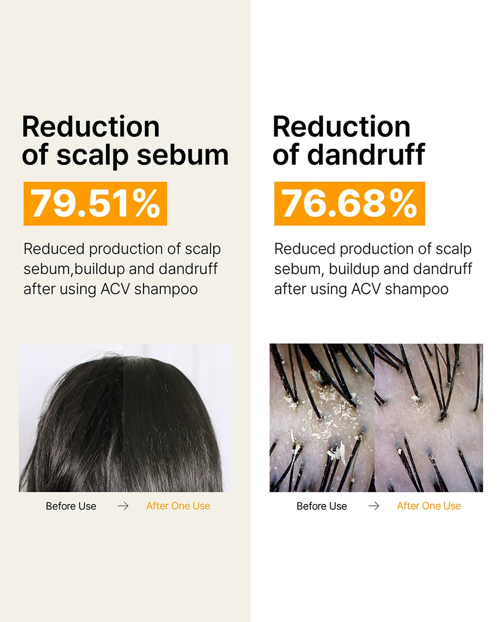 LADOR ACV Vinegar Shampoo 150ml